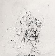 Albrecht Durer Sele-Portrait with Bandage oil painting